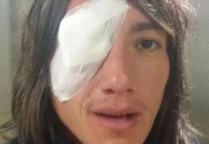 Pablo Lugüercio fue golpeado durante el calentamiento previo de Aldosivi-Lanus
