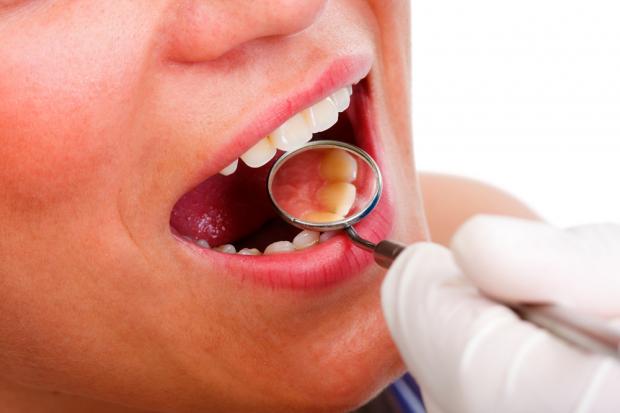 preventing-oral-cancer