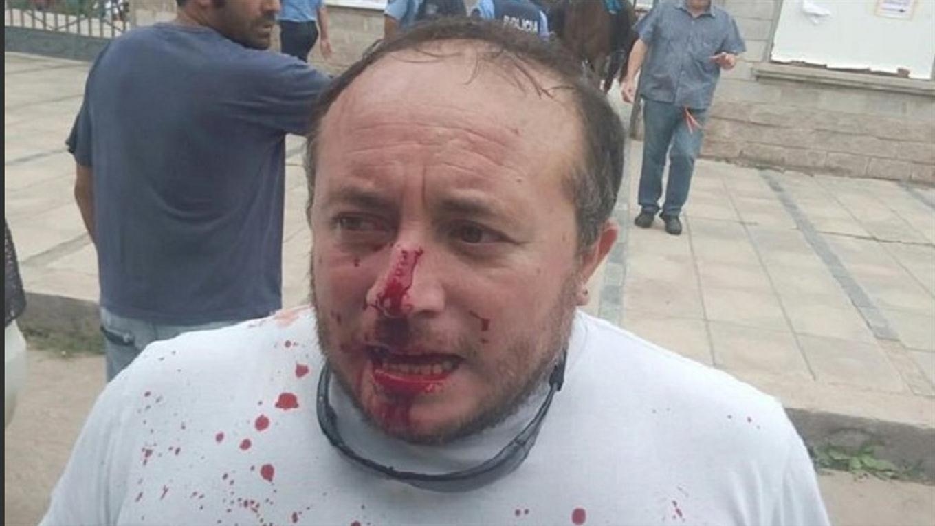 gremialista golpeado ATE