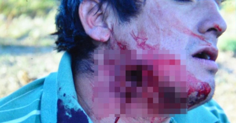 represion02