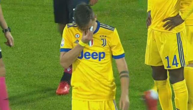 dybala_lesion_060120181