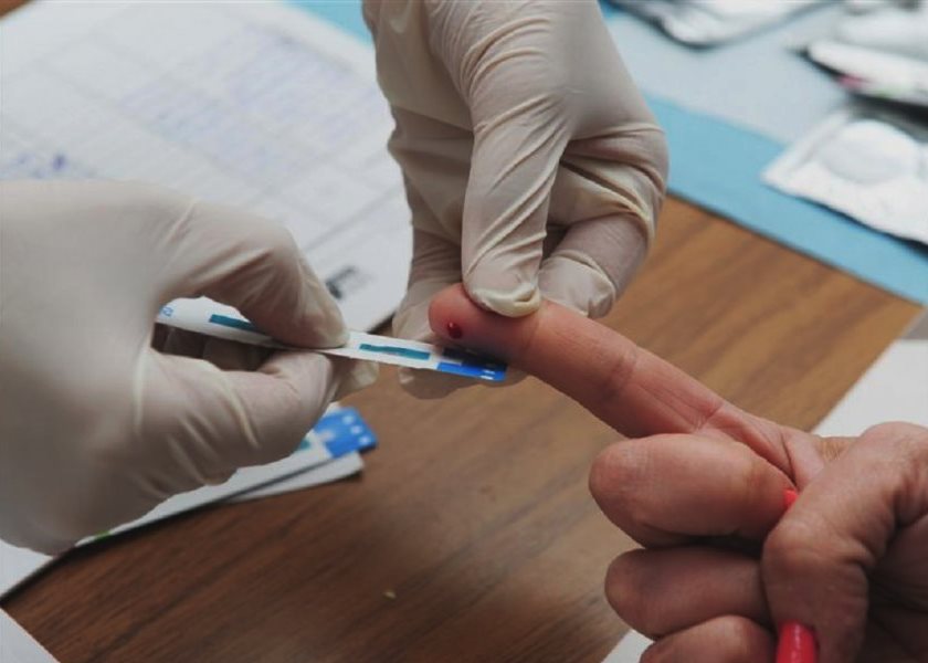 hiv