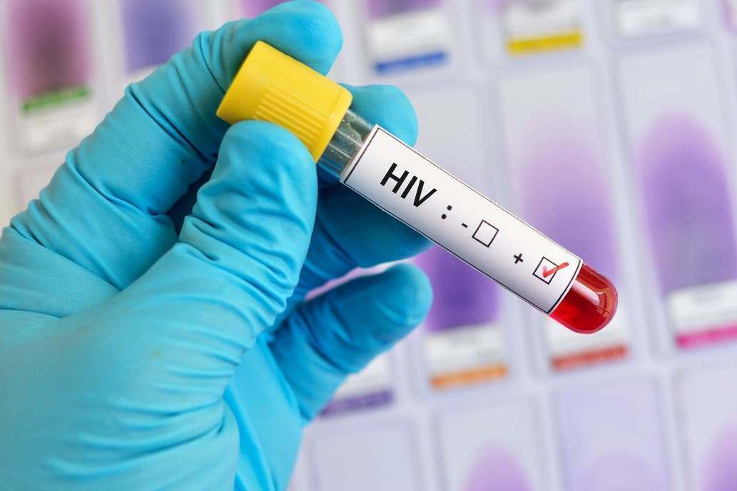 HIV