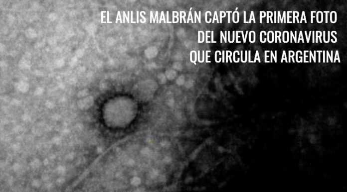 virus